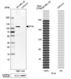 IFI16 Antibody, Novus Biologicals:Antibodies:Primary Antibodies
