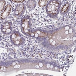 IFI44L Antibody, Novus Biologicals 0.1mL; Unlabeled:Antibodies, Polyclonal