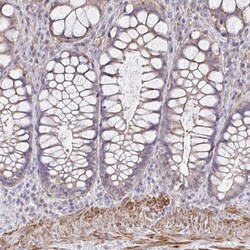IFI44L Antibody, Novus Biologicals 0.1mL; Unlabeled:Antibodies, Polyclonal