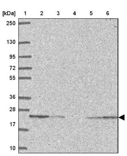 IFI44L Antibody, Novus Biologicals 0.1mL; Unlabeled:Antibodies, Polyclonal