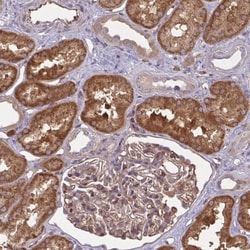 IFIT3 Antibody, Novus Biologicals 25 &mu;L, Unlabeled:Antibodies, Polyclonal