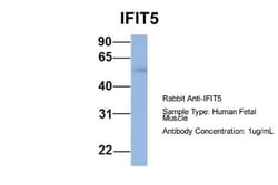 IFIT5 Antibody, Novus Biologicals 100&mu;L; Unlabeled:Antibodies, Polyclonal