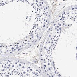 IFITM1 Antibody, Novus Biologicals 0.1mL; Unlabeled:Antibodies, Polyclonal
