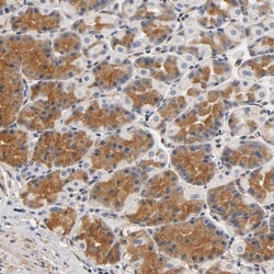 IFITM3/Fragilis Antibody, Novus Biologicals 25 &mu;L | Buy Online | Novus Biologicals | Fisher Scientific