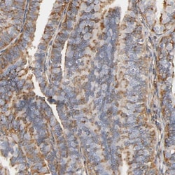 IFITM3/Fragilis Antibody, Novus Biologicals 25 &mu;L | Buy Online | Novus Biologicals | Fisher Scientific