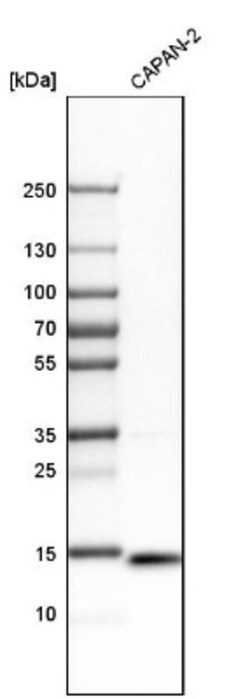IFITM3/Fragilis Antibody, Novus Biologicals 25 &mu;L | Buy Online | Novus Biologicals | Fisher Scientific