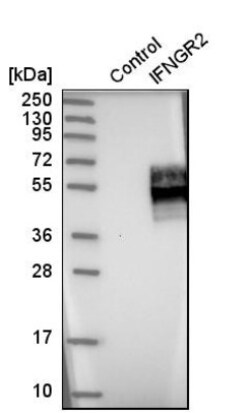 IFN-gamma R2 Antibody, Novus Biologicals:Antibodies:Primary Antibodies