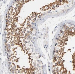 IFT43 Antibody, Novus Biologicals 25 &mu;L | Buy Online | Novus Biologicals | Fisher Scientific