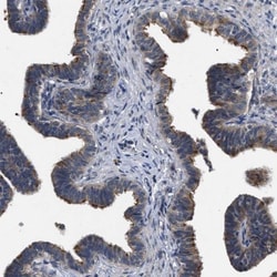 IFT81 Antibody, Novus Biologicals:Antibodies:Primary Antibodies
