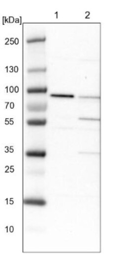 IFT81 Antibody, Novus Biologicals:Antibodies:Primary Antibodies