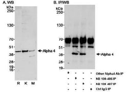 IGBP1 Antibody, Novus Biologicals 0.1mL; Unlabeled:Antibodies, Polyclonal