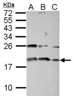 IGF-I/IGF-1 Antibody, Novus Biologicals 0.1 mL | Buy Online | Novus Biologicals | Fisher Scientific
