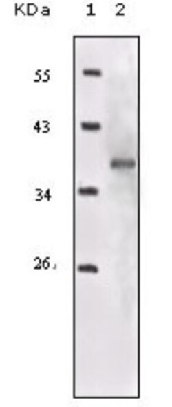 IGF-I R/IGF1R Antibody (3G5C1), Novus Biologicals 0.025mL; Unlabeled:Antibodies,