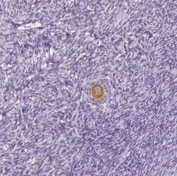 IGF2BP1 Antibody, Novus Biologicals 0.1mL; Unlabeled:Antibodies, Polyclonal