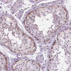 IGF2BP1 Antibody, Novus Biologicals 0.1mL; Unlabeled:Antibodies, Polyclonal
