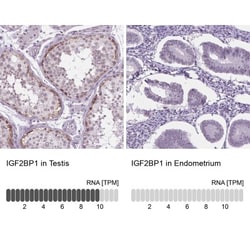 IGF2BP1 Antibody, Novus Biologicals 0.1mL; Unlabeled:Antibodies, Polyclonal