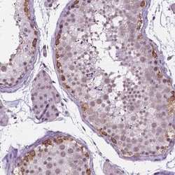 IGF2BP1 Antibody, Novus Biologicals 0.1mL; Unlabeled:Antibodies, Polyclonal