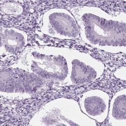 IGF2BP1 Antibody, Novus Biologicals:Antibodies:Primary Antibodies