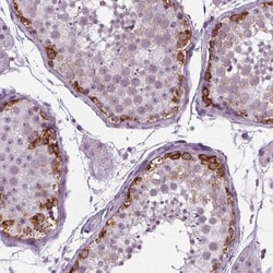IGF2BP1 Antibody, Novus Biologicals:Antibodies:Primary Antibodies