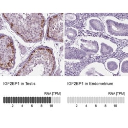 IGF2BP1 Antibody, Novus Biologicals:Antibodies:Primary Antibodies