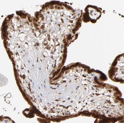 IGF2BP3 Antibody, Novus Biologicals:Antibodies:Primary Antibodies