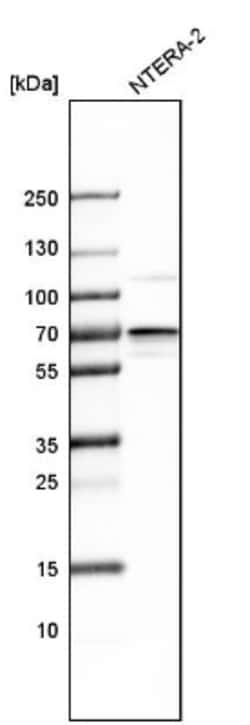 IGF2BP3 Antibody, Novus Biologicals:Antibodies:Primary Antibodies