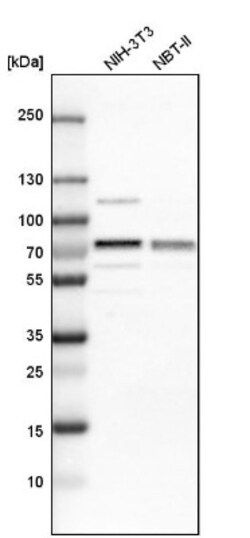 IGF2BP3 Antibody, Novus Biologicals:Antibodies:Primary Antibodies