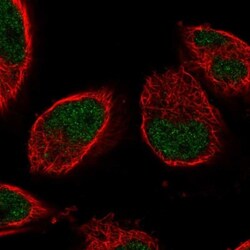 IGFALS/ALS Antibody, Novus Biologicals:Antibodies:Primary Antibodies