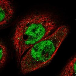 IGFALS/ALS Antibody, Novus Biologicals 25 &mu;L; Unlabeled:Antibodies,