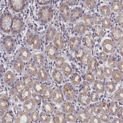 IGFALS/ALS Antibody, Novus Biologicals:Antibodies:Primary Antibodies