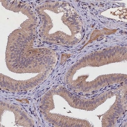 IGFALS/ALS Antibody, Novus Biologicals:Antibodies:Primary Antibodies