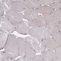 IGFALS/ALS Antibody, Novus Biologicals:Antibodies:Primary Antibodies