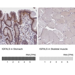 IGFALS/ALS Antibody, Novus Biologicals:Antibodies:Primary Antibodies