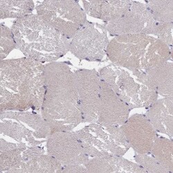 IGFALS/ALS Antibody, Novus Biologicals 25 &mu;L; Unlabeled:Antibodies,