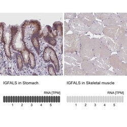 IGFALS/ALS Antibody, Novus Biologicals 25 &mu;L; Unlabeled:Antibodies,
