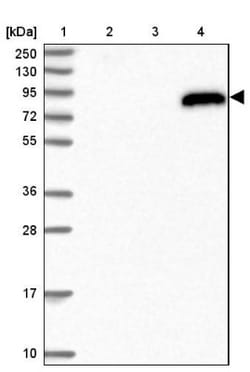 IGFALS/ALS Antibody, Novus Biologicals:Antibodies:Primary Antibodies