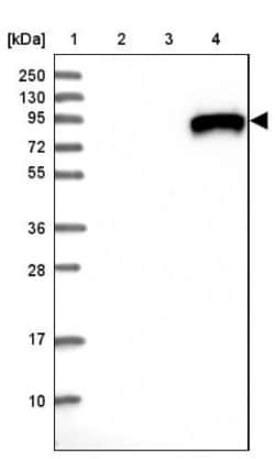 IGFALS/ALS Antibody, Novus Biologicals 25 &mu;L; Unlabeled:Antibodies,