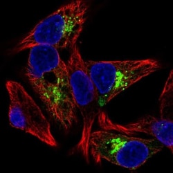 IGFBP-1 Antibody, Novus Biologicals 25 &mu;L, Unlabeled:Antibodies, Polyclonal