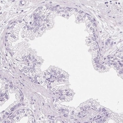 IGFBP-1 Antibody, Novus Biologicals 25 &mu;L, Unlabeled:Antibodies, Polyclonal