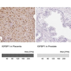IGFBP-1 Antibody, Novus Biologicals 25 &mu;L, Unlabeled:Antibodies, Polyclonal
