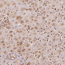 IGFBP-1 Antibody, Novus Biologicals:Antibodies:Primary Antibodies