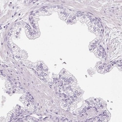 IGFBP-1 Antibody, Novus Biologicals:Antibodies:Primary Antibodies