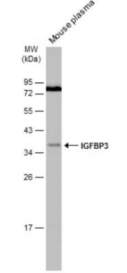 IGFBP-3 Antibody, Novus Biologicals 0.1mL; Unlabeled:Antibodies, Polyclonal