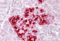 IGFBP-rp1/IGFBP-7 Antibody, Novus Biologicals 0.1mg; Unlabeled:Antibodies,