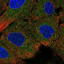 IGFL4 Antibody, Novus Biologicals 0.1mL; Unlabeled:Antibodies, Polyclonal