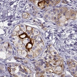 IGSF1 Antibody, Novus Biologicals 0.1mL; Unlabeled:Antibodies, Polyclonal