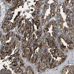 IGSF10 Antibody, Novus Biologicals 25 &mu;L | Buy Online | Novus Biologicals | Fisher Scientific
