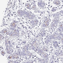 IGSF23 Antibody, Novus Biologicals:Antibodies:Primary Antibodies