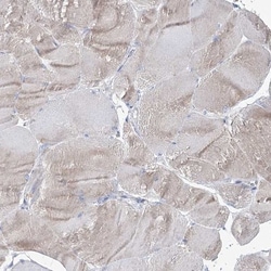IGSF3 Antibody, Novus Biologicals 0.1mL; Unlabeled:Antibodies, Polyclonal