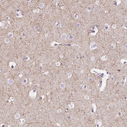 IGSF4C/SynCAM4 Antibody, Novus Biologicals:Antibodies:Primary Antibodies